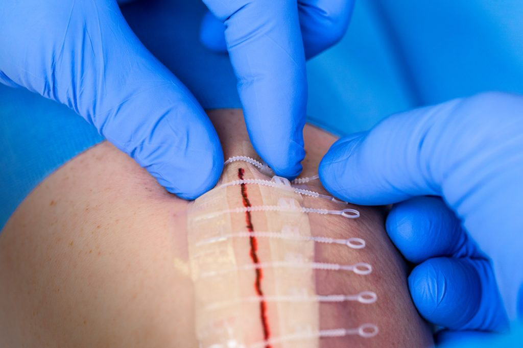 Tightening-the-straps-1024x682-no logo