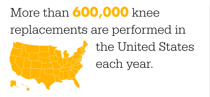 More than 600,000 knee replacements are performed in the United States each year