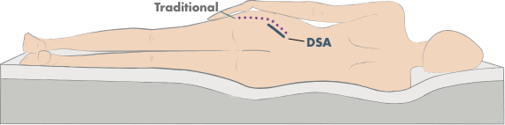 Direct superior approach person laying on side